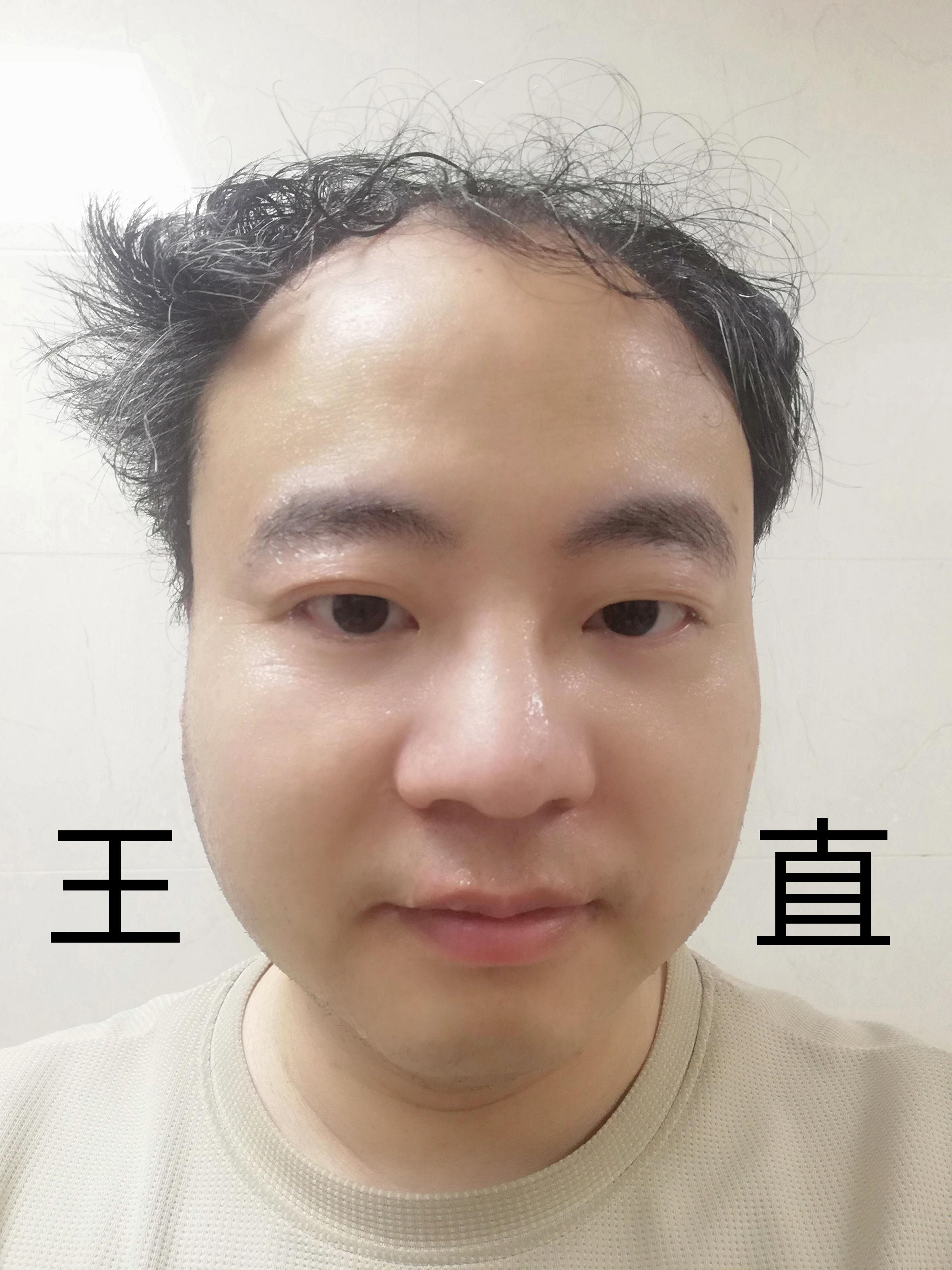 王直海贼王图片